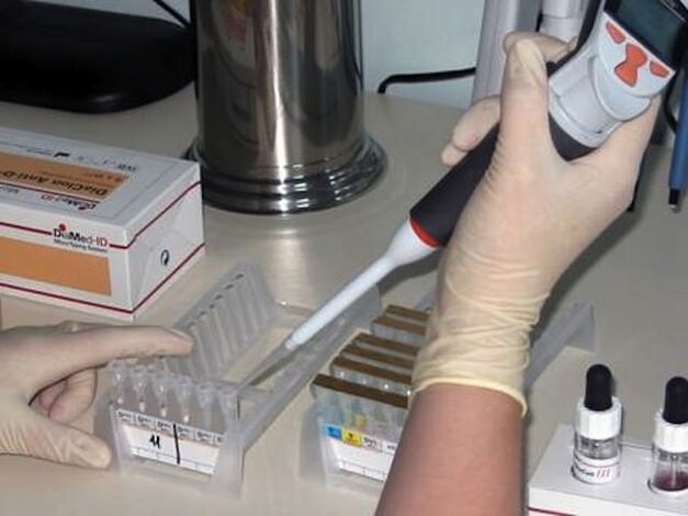Laboratorní testy k diagnostice parazitárních onemocnění